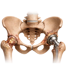 Hip