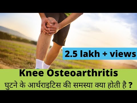Knee Osteoarthritis