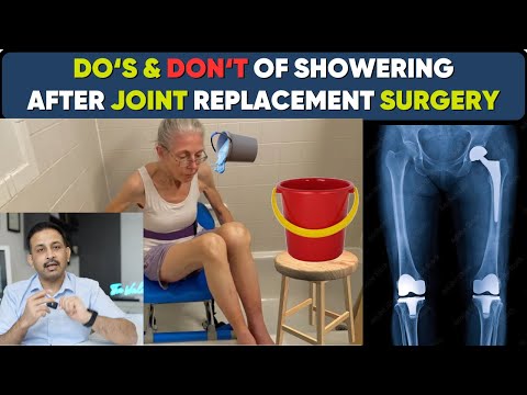 Joint Replacement Surgery