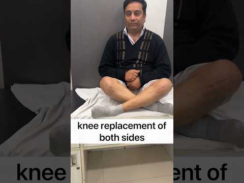 Knee Replacement Surgery