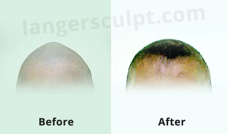 Craniofacial Surgery