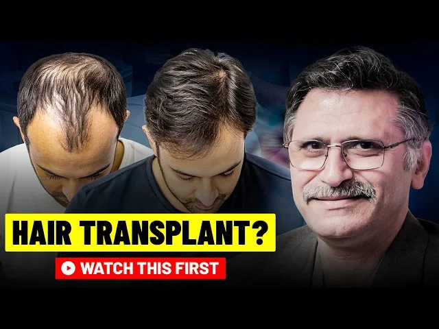 Hair Transplant Secrets Revealed | Natural Results, Timeline & Grafts